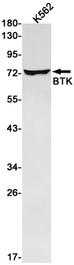 Western blot detection of BTK in K562 cell lysates using BTK Rabbit pAb(1:1000 diluted).Predicted band size:76kDa.Observed band size:76kDa.