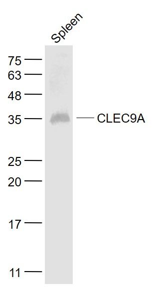 Fig1: Sample:; Spleen (Mouse) Lysate at 40 ug; Primary: Anti- CLEC9A at 1/1000 dilution; Secondary: IRDye800CW Goat Anti-Rabbit IgG at 1/20000 dilution; Predicted band size: 27 kD; Observed band size: 35 kD