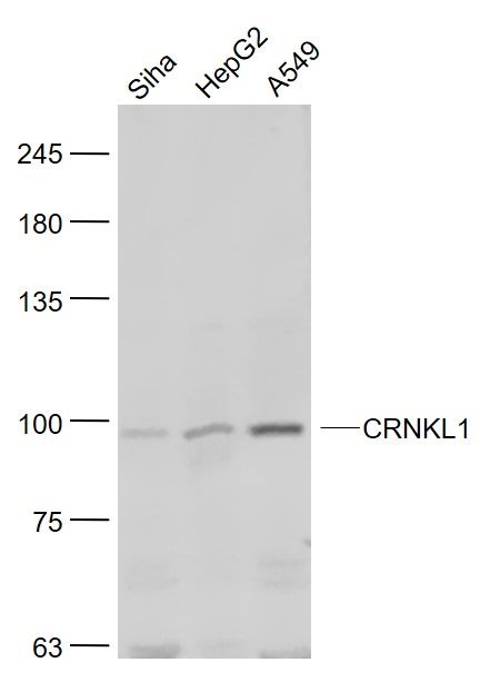 Fig1: Sample:; Siha(Human) Cell Lysate at 30 ug; HepG2(Human) Cell Lysate at 30 ug; A549(Human) Cell Lysate at 30 ug; Primary: Anti- CRNKL1 at 1/1000 dilution; Secondary: IRDye800CW Goat Anti-Rabbit IgG at 1/20000 dilution; Predicted band size: 100 kD; Observed band size: 98 kD