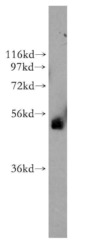 MCF7 cells were subjected to SDS PAGE followed by western blot with Catalog No:115999(TFAP2B antibody) at dilution of 1:800