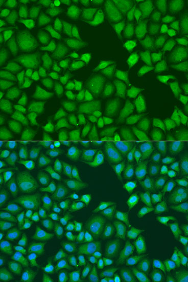 Immunofluorescence - TNRC6A Polyclonal Antibody 