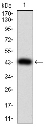 Fig1: Western blot analysis of ULK2 on human ULK2 recombinant protein using anti-ULK2 antibody at 1/1,000 dilution.