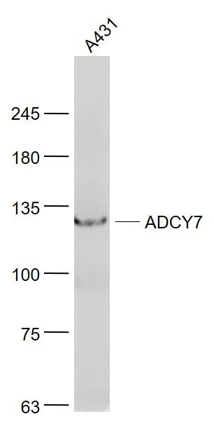 Fig2: Sample:; A431(Human) Cell Lysate at 30 ug; Primary: Anti- ADCY7 at 1/1000 dilution; Secondary: IRDye800CW Goat Anti-Rabbit IgG at 1/20000 dilution; Predicted band size: 120 kD; Observed band size: 120 kD