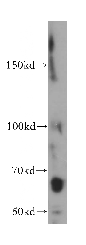 MCF7 cells were subjected to SDS PAGE followed by western blot with Catalog No:115738(STS antibody) at dilution of 1:500