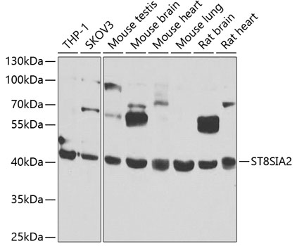Western blot - ST8SIA2 Polyclonal Antibody 