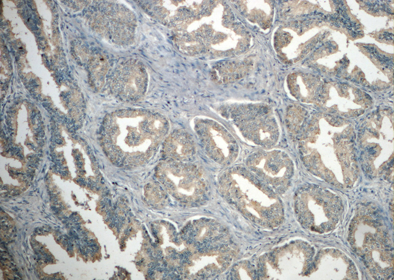 Immunohistochemistry of paraffin-embedded human prostate hyperplasia slide using Catalog No:111712(HTR4 Antibody) at dilution of 1:50