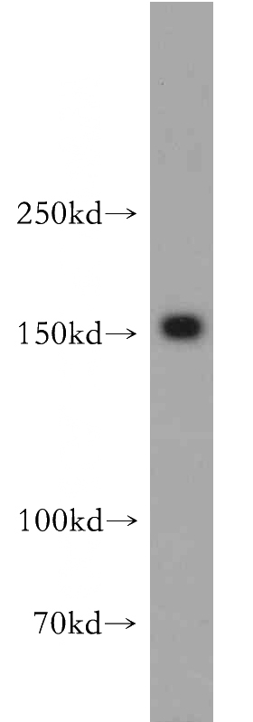 HepG2 cells were subjected to SDS PAGE followed by western blot with Catalog No:114331(PTPRZ1 antibody) at dilution of 1:500