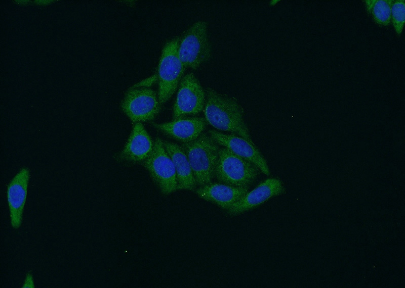 Immunofluorescent analysis of HeLa cells using Catalog No:115690(STAT4 Antibody) at dilution of 1:50 and Alexa Fluor 488-congugated AffiniPure Goat Anti-Rabbit IgG(H+L)