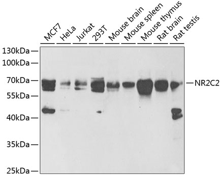 Western blot - NR2C2 Polyclonal Antibody 