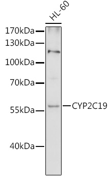 Western blot - CYP2C19 Polyclonal Antibody 