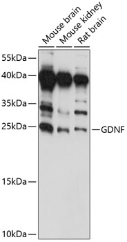 Western blot - GDNF Polyclonal Antibody 