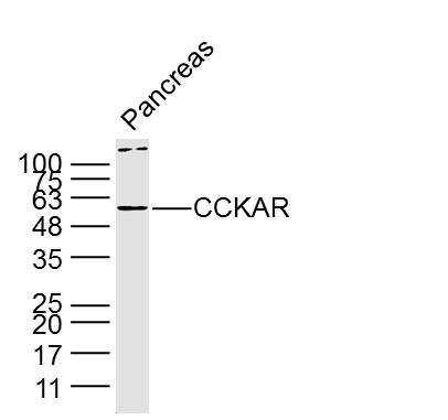 Fig1: Sample: Pancreas (Mouse) Lysate at 40 ug; Primary: Anti-CCKAR at 1/300 dilution; Secondary: IRDye800CW Goat Anti-Rabbit IgG at 1/20000 dilution; Predicted band size: 48 kD; Observed band size: 60 kD