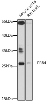 Western blot - PRB4 Polyclonal Antibody 