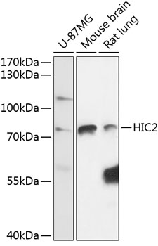 Western blot - HIC2 Polyclonal Antibody 