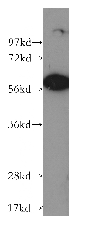 BxPC-3 cells were subjected to SDS PAGE followed by western blot with Catalog No:109135(CD69 antibody) at dilution of 1:2000