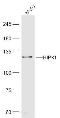 Fig2: Sample:; Mcf-7(Human) Cell Lysate at 40 ug; Primary: Anti-HIPK1 at 1/300 dilution; Secondary: IRDye800CW Goat Anti-Rabbit IgG at 1/20000 dilution; Predicted band size: 131 kD; Observed band size: 131kD