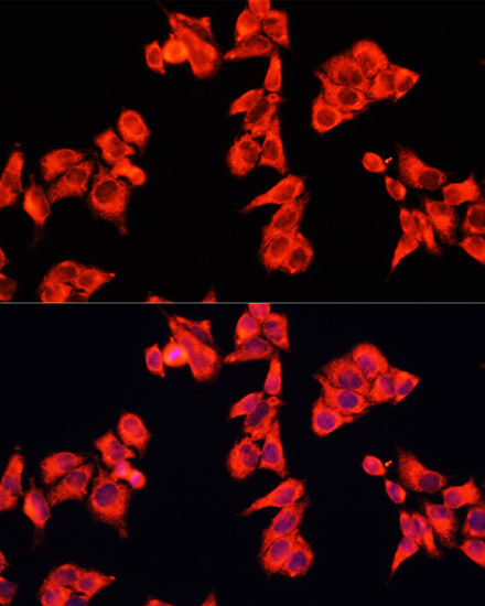Immunofluorescence - ARHGAP5 Polyclonal Antibody 