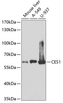 Western blot - CES1 Polyclonal Antibody 