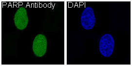 Immunofluorescent analysis of Hela cells, using PARP Antibody .
