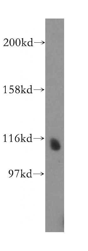 K-562 cells were subjected to SDS PAGE followed by western blot with Catalog No:113097(NEDD4L antibody) at dilution of 1:500