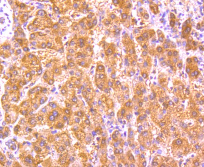 Fig5: Immunohistochemical analysis of paraffin-embedded human liver tissue using anti-GPX5 antibody. Counter stained with hematoxylin.