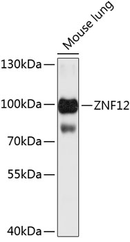 Western blot - ZNF12 Polyclonal Antibody 