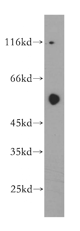 HepG2 cells were subjected to SDS PAGE followed by western blot with Catalog No:108055(ANGPTL1 antibody) at dilution of 1:300