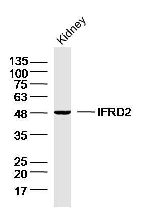 Fig2: Sample:Kidney (Mouse) Lysate at 40 ug; Primary: Anti-IFRD2 at 1/300 dilution; Secondary: IRDye800CW Goat Anti-Rabbit IgG at 1/20000 dilution; Predicted band size: 55kD; Observed band size: 48kD