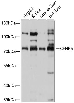 Western blot - CFHR5 Polyclonal Antibody 