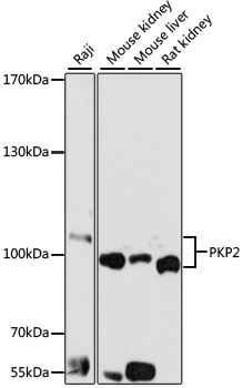 Western blot - PKP2 Polyclonal Antibody 