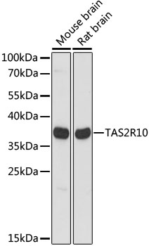Western blot - TAS2R10 Polyclonal Antibody 