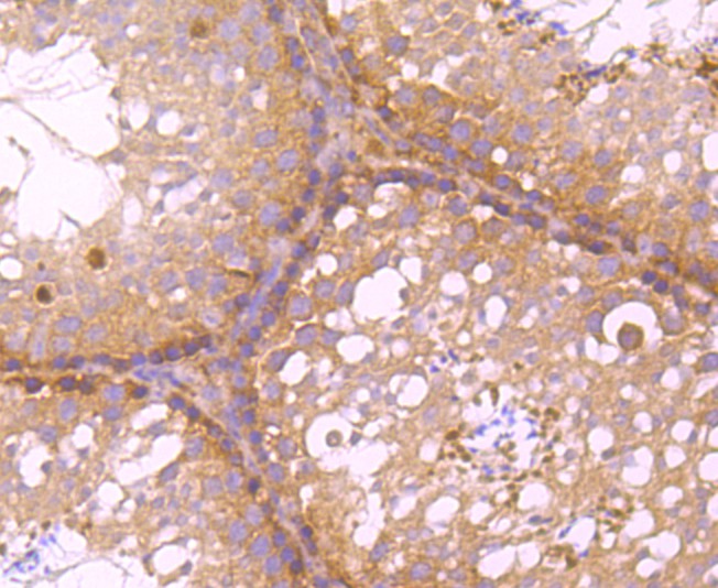Fig6: Immunohistochemical analysis of paraffin-embedded mouse testis tissue using anti-C12orf51 antibody. Counter stained with hematoxylin.