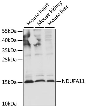 Western blot - NDUFA11 Polyclonal Antibody 