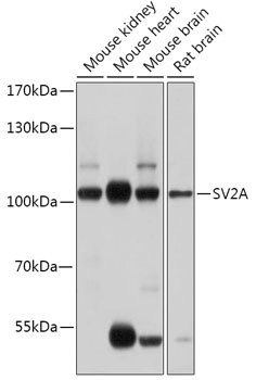 Western blot - SV2A Polyclonal Antibody 