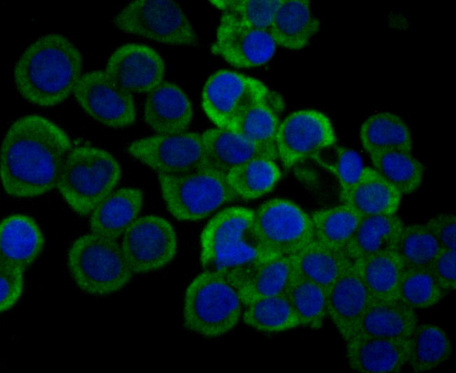 Fig3: ICC staining IL-31 (green) in LOVO cells. The nuclear counter stain is DAPI (blue). Cells were fixed in paraformaldehyde, permeabilised with 0.25% Triton X100/PBS.