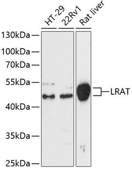 Western blot - LRAT Polyclonal Antibody 
