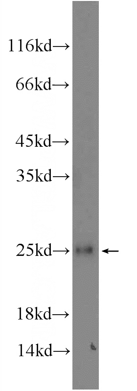 Raji cells were subjected to SDS PAGE followed by western blot with Catalog No:110902(GCET2 Antibody) at dilution of 1:300
