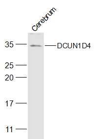 Fig1: Sample:; Cerebrum (Mouse) Lysate at 40 ug; Primary: Anti-DCUN1D4 at 1/500 dilution; Secondary: IRDye800CW Goat Anti-Rabbit IgG at 1/20000 dilution; Predicted band size: 34 kD; Observed band size: 34 kD