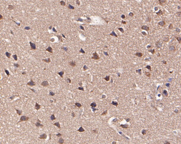 Fig2:; Immunohistochemical analysis of paraffin-embedded rat brain tissue using anti-KCNN2 antibody. The section was pre-treated using heat mediated antigen retrieval with Tris-EDTA buffer (pH 8.0-8.4) for 20 minutes.The tissues were blocked in 5% BSA for 30 minutes at room temperature, washed with ddH; 2; O and PBS, and then probed with the primary antibody ( 1/100) for 30 minutes at room temperature. The detection was performed using an HRP conjugated compact polymer system. DAB was used as the chromogen. Tissues were counterstained with hematoxylin and mounted with DPX.