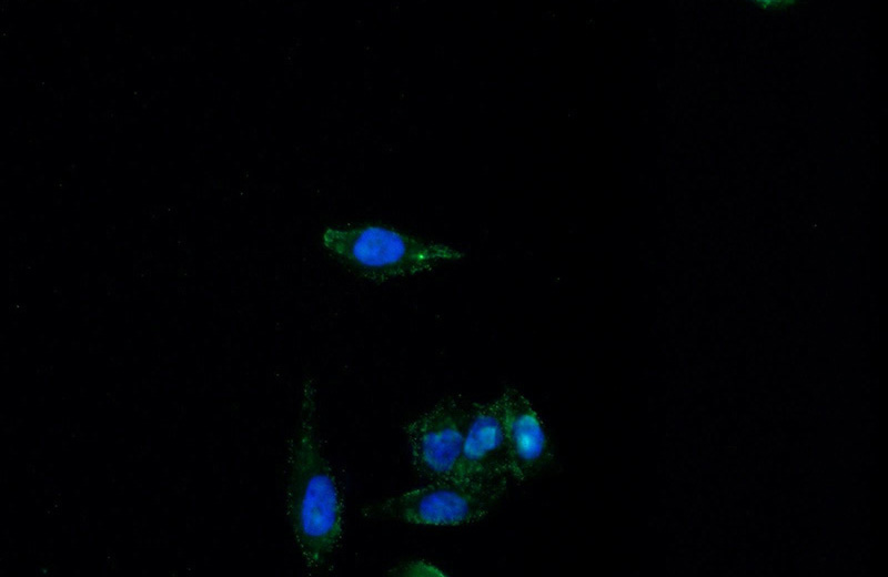 Immunofluorescent analysis of HeLa cells using Catalog No:111824(IQGAP1 Antibody) at dilution of 1:50 and Alexa Fluor 488-congugated AffiniPure Goat Anti-Rabbit IgG(H+L)