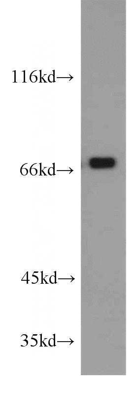 Jurkat cells were subjected to SDS PAGE followed by western blot with Catalog No:114598(RBM14 antibody) at dilution of 1:800