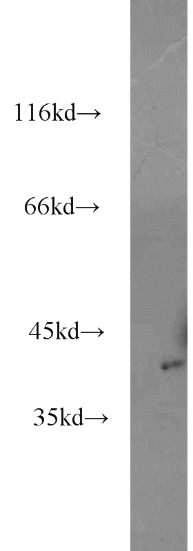 human heart tissue were subjected to SDS PAGE followed by western blot with Catalog No:115563(SMS antibody) at dilution of 1:800