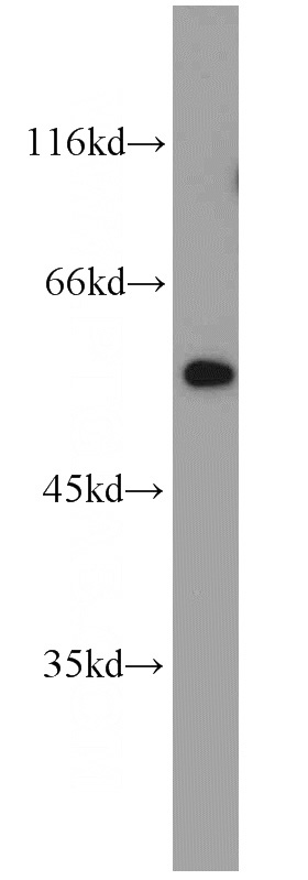 Jurkat cells were subjected to SDS PAGE followed by western blot with Catalog No:110660(FBRS antibody) at dilution of 1:500