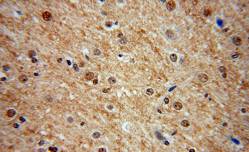 Immunohistochemical of paraffin-embedded human brain using Catalog No:112570(MDM1 antibody) at dilution of 1:100 (under 40x lens)