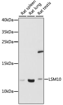Western blot - LSM10 Polyclonal Antibody 