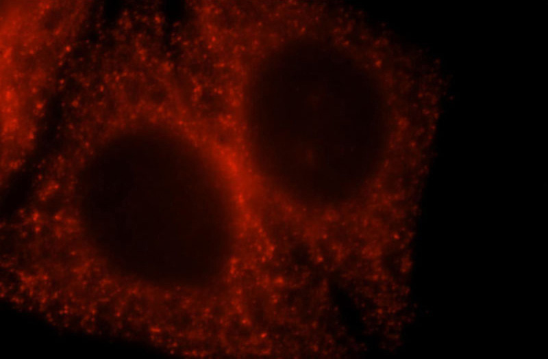 Immunofluorescent analysis of HepG2 cells, using USP24 antibody Catalog No:116601 at 1:25 dilution and Rhodamine-labeled goat anti-rabbit IgG (red).