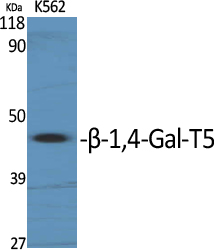 Fig1:; Western Blot analysis of various cells using β-1,4-Gal-T5 Polyclonal Antibody diluted at 1: 1000. Secondary antibody（catalog#: HA1001) was diluted at 1:20000