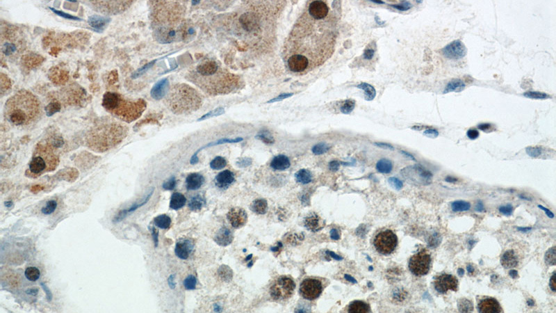 Immunohistochemical of paraffin-embedded human testis using Catalog No:115141(SF4 antibody) at dilution of 1:100 (under 40x lens)