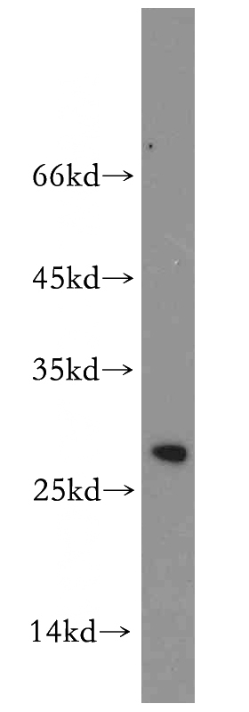 Jurkat cells were subjected to SDS PAGE followed by western blot with Catalog No:116715(VAPB antibody) at dilution of 1:500