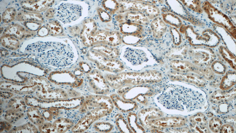 Immunohistochemistry of paraffin-embedded human kidney tissue slide using Catalog No:110390(EPO Antibody) at dilution of 1:50 (under 10x lens)